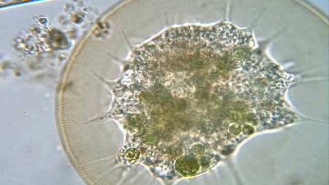 Arcella sp. from Mer Bleu смотреть онлайн