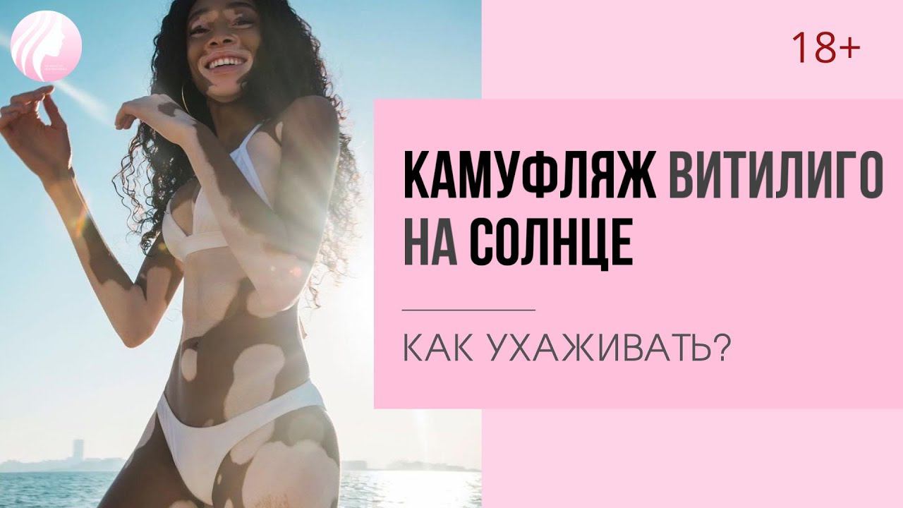 ВИТИЛИГО. УХОД ЗА КАМУФЛЯЖЕМ витилиго. Сколько держится камуфляж витилиго на солнце?