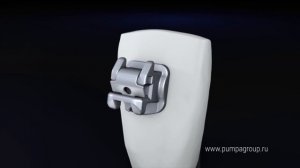 Основание брекетов BioQuick