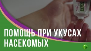 Помощь при укусах насекомых