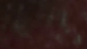 Свежая капля крови человека под микроскопом