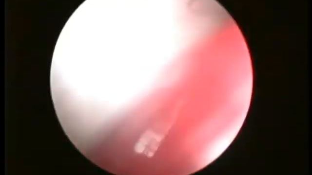 Эндохирургия стерилизация кота смотреть онлайн