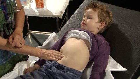 Paediatric Clinical Examinations - The Abdomen