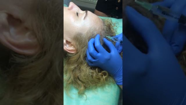 Мезотерапия и биоревитализация. Мезотерапия в трихологии. Практика смотреть онлайн