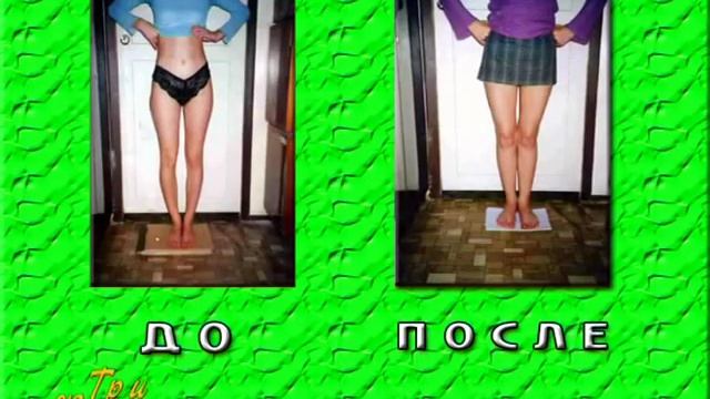 Лечение кривых ног в Саратове.avi смотреть онлайн