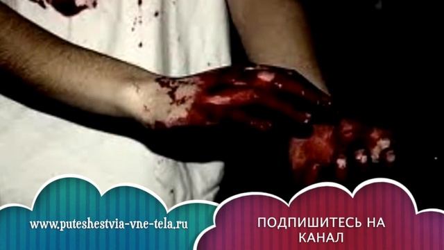 СОННИК - Кровь во сне