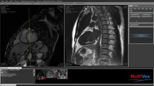 Обзор программы для обработки МРТ изображений, зарегистрированных в разных режимах МР томографа