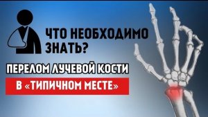 Перелом лучевой кости. В "Типичном месте". Что нужно знать? (Гипс, Отек, Операция, Упражнения...)