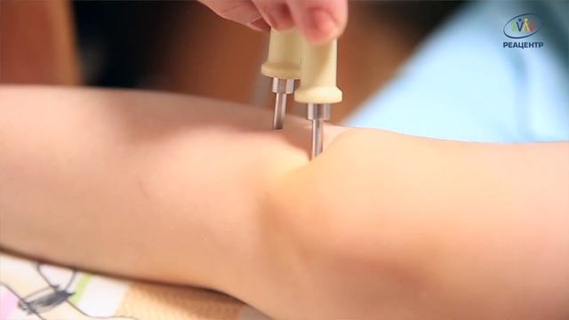 Рефлексотерапия для особенных детей