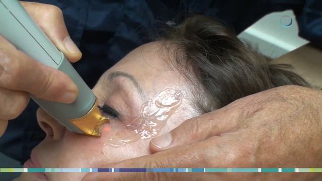 Vantage Laser смотреть онлайн