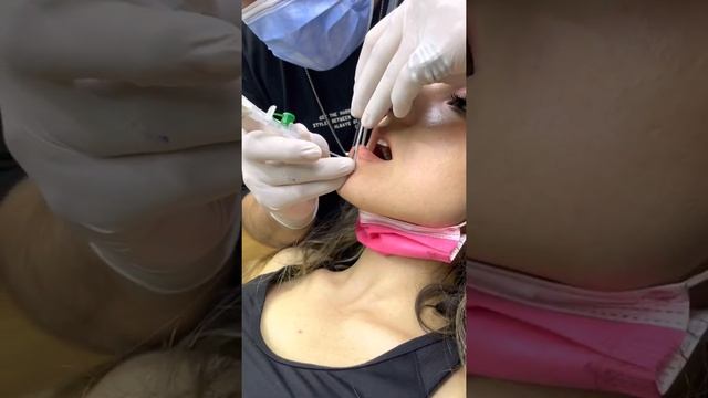 Dudak delim işlemi смотреть онлайн