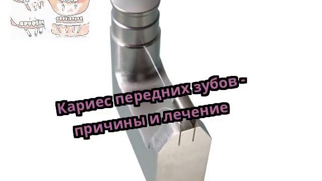 Кариес передних зубов - причины и лечение смотреть онлайн