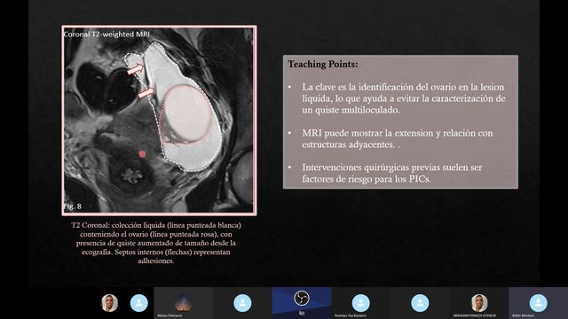 O RADS 1er Parte смотреть онлайн