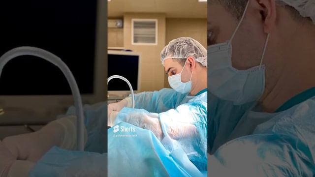 Бесшовное увеличение груди: новые возможности красоты! Мамопластика.
