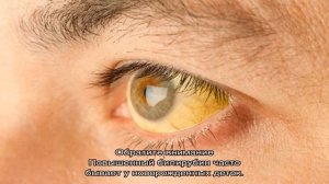 Как лечить повышенный билирубин