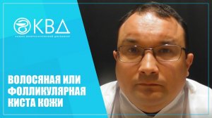 1314 Волосяная или фолликулярная киста кожи