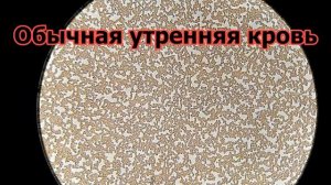 Кровь после аспирина