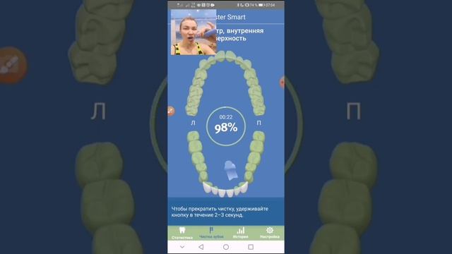 Как работает Glister Smart Sonic
