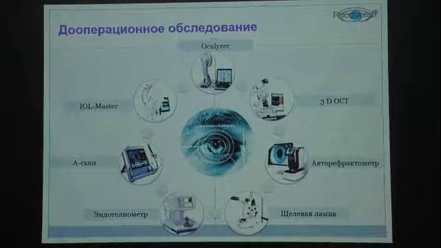 Клинический опыт применения заднекамерных факичных ИОЛ IPCL с цель коррекции миопии высокой степени