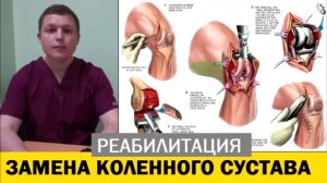 Коленный сустав Реабилитация Замена сустава Total Knee Replacement