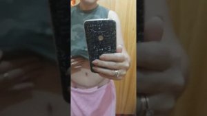 Абдоминопластика 3 недели