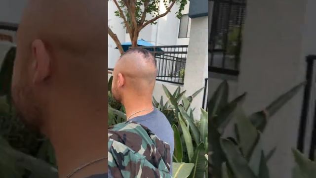 Hair Loss #Shorts смотреть онлайн