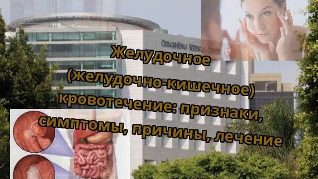 Желудочное (желудочно-кишечное) кровотечение: признаки, симптомы, причины, лечение смотреть онлайн