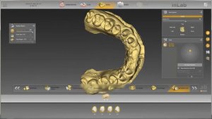 1 to 1 Copy Mode - inLab SW - Dentsply Sirona