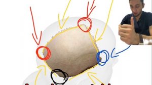 Анатомия теменной кости os parietale