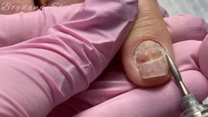 Дизайн ногтей вуаль.Как отодвинуть налипшую кутикулу.Повреждённый ноготь.