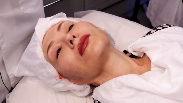 Мезонитевая коррекция C использованием нитей различных модификаций