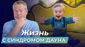 Жизнь с синдромом Дауна: признаки и причины заболевания