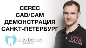 #Стоматолог Стас Белоус ДЕМОНСТРАЦИЯ #CEREC CAD/CAM В САНКТ-ПЕТЕРБУРГ