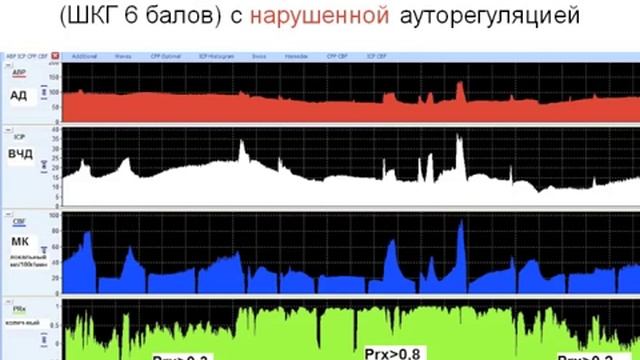 1МСН ЦПД в Нейрореанимации. (перфузия головного мозга)