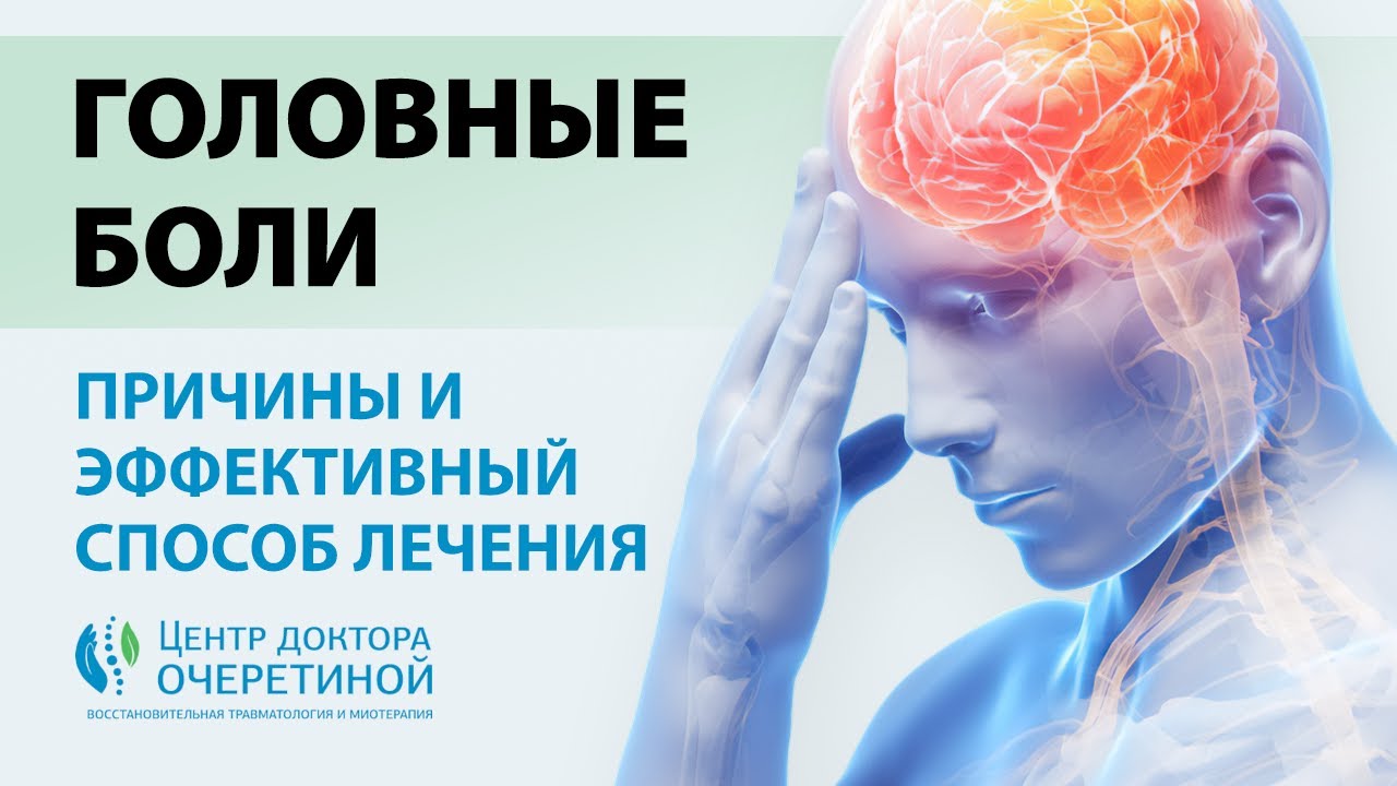 Головная боль | Самый ЭФФЕКТИВНЫЙ способ ЛЕЧЕНИЯ