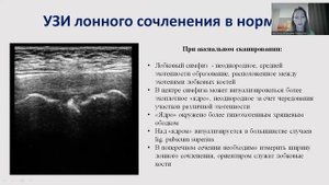 УЗ диагностика симфизита. Некрасова В. В.