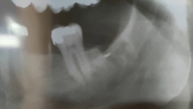 Сломать челюсть?!Да запросто! смотреть онлайн