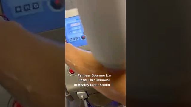 Painless Soprano Ice laser hair removal