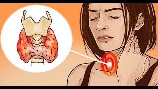 НАРОДНОЕ ЛЕЧЕНИЕ ЩИТОВИДНОЙ ЖЕЛЕЗЫ смотреть онлайн