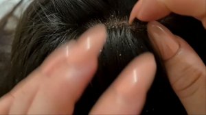 ASMR- Relaxing scalp check for sleep / ZOOM #scratching #longnails #asmrsleep #scalp #tweezers