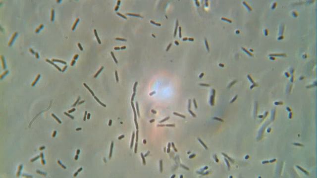 Л 2 молодая культура МПА комнатная температура смотреть онлайн