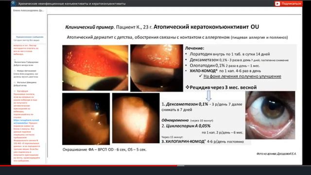 Хронические неинфекционные конъюнктивиты и кератоконъюнктивиты - лектор: Дроздова Е.А