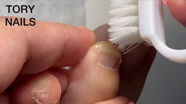 Аппаратный педикюр Обработка пальчиков в аппаратной технике Безопасная фреза в педикюре Pedicure смотреть онлайн