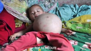 10 Persons with GENETIC CHANGE SPECIAL! Mutations incredible Very RARE