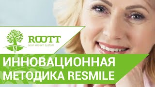 Полное восстановление зубов за 3 дня. Методика ReSmile на имплантах ROOTT.