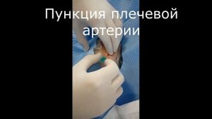 Пункция плечевой артерии