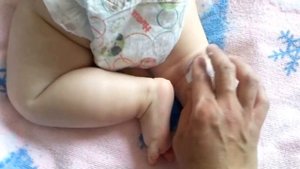 Как лечить опрелости в складочках у ребенка