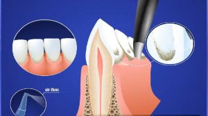 Гигиена и профилактика Профгигиена Этапы применения x264