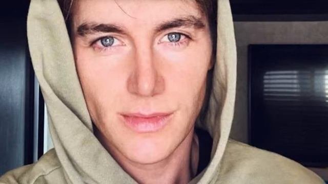 Алексей Воробьев изуродовал собственное лицо