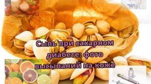 Сыпь при сахарном диабете: фото высыпаний на коже